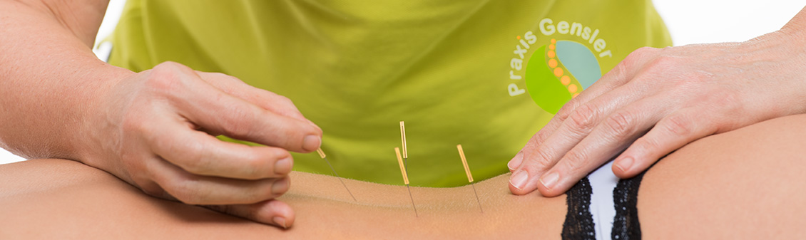 Foto Akupunktur